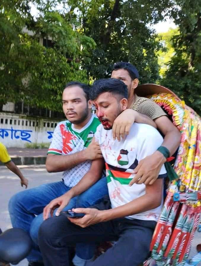 not_samurai69's tweet photo. Awami government controlled chatroleauge attacks student many students are in hospital now!!#Internationalmedia plz cover the news help us #Bangladesh medias aren't showing the truth .we need help.
#Bangladesh #StepDownHasina #removequota #DhakaUniversity #Dhaka https://t.co/HSayvZyLKF