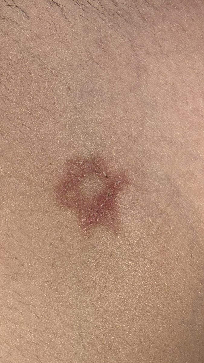 healing update