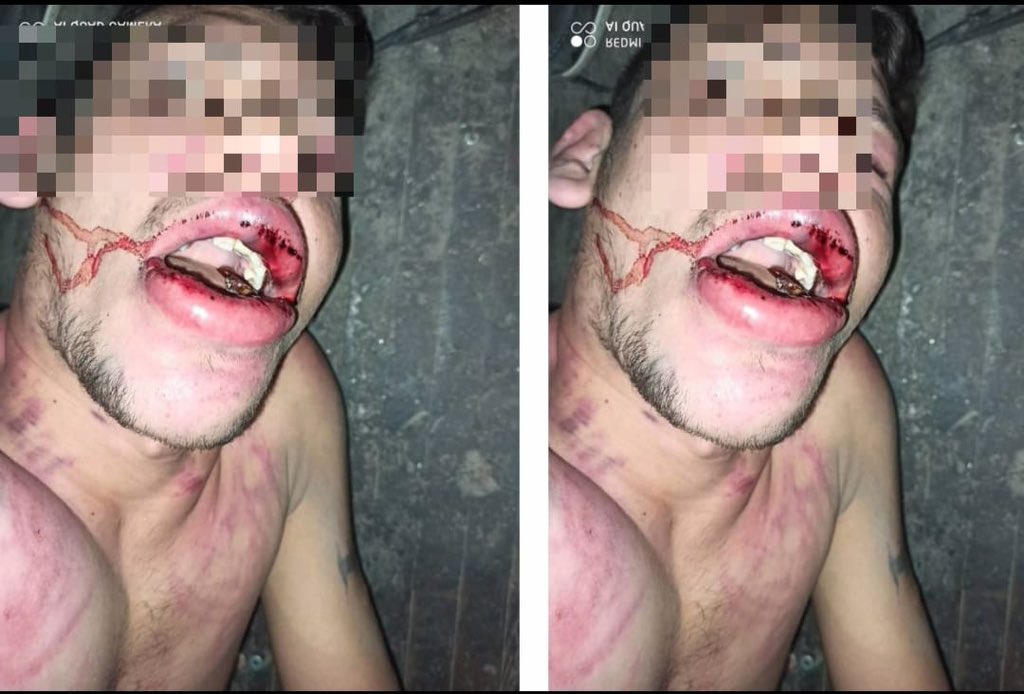 (+18 HASSAS İÇERİK)

Adı Vedat Kurt 22 yaşında

Bizlere gelerek bir konu hakkında bilgi vermek istediğini söyledi.
Bizlerde kendisini dinledik.
Bakın Vedat Kurt neler söyledi.

Şanlıurfa Suruç nufüsüna kayıtlıyım.
Babam yıllar önce vefat etti.
Annem ve bir kardeşim ile birlikte