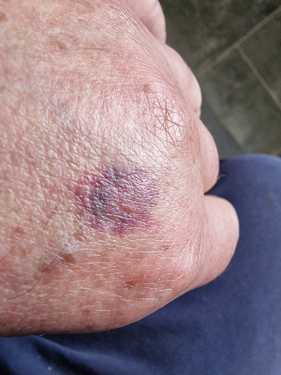 Sir Peter Morris: Just fed up of all the nonsense. tweet media