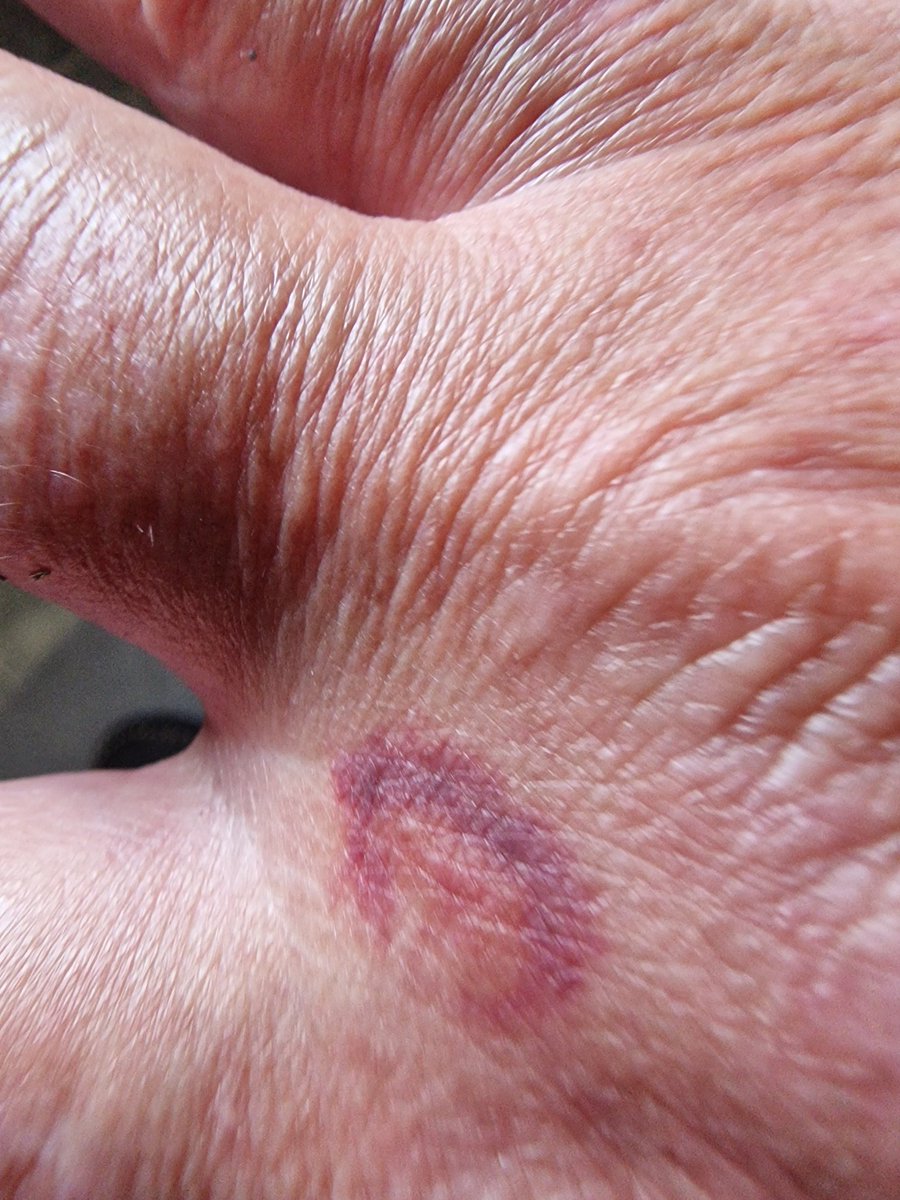 Sir Peter Morris: Just fed up of all the nonsense. tweet media