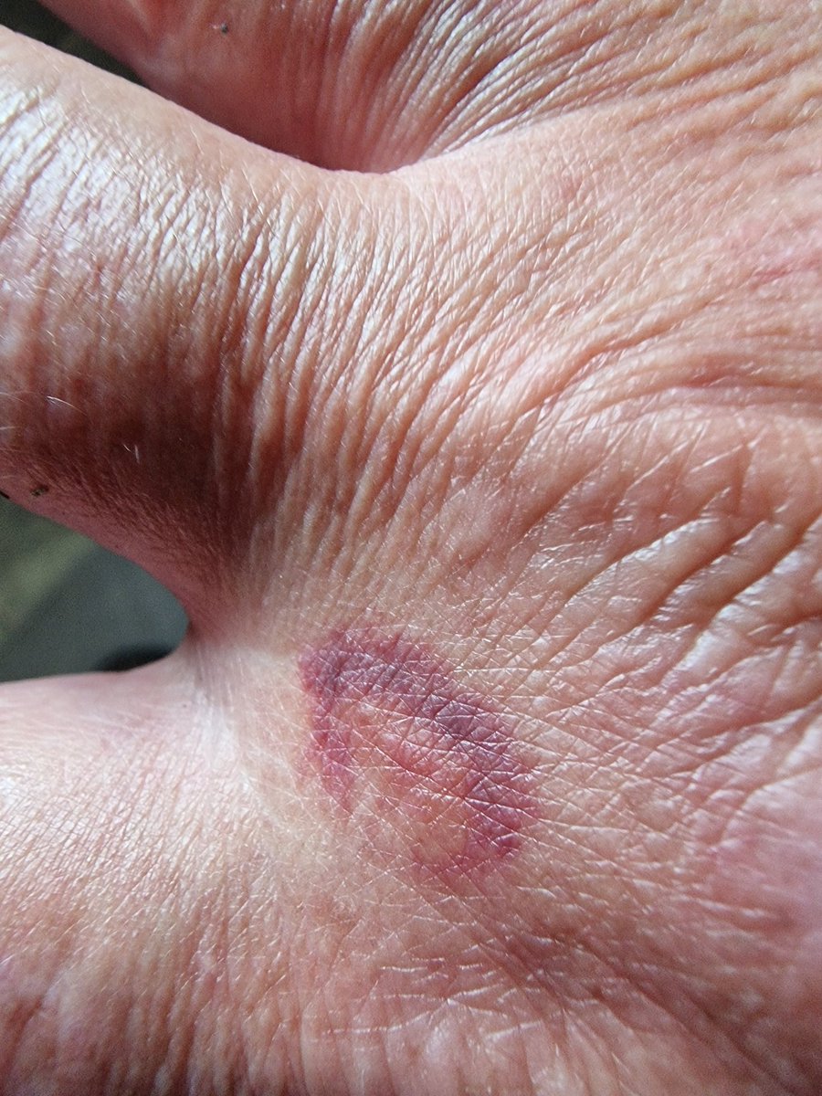 Sir Peter Morris: Just fed up of all the nonsense. tweet media