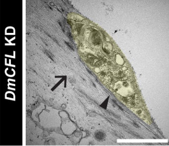 focalplane_jcs's tweet photo. On our return to #EmMonday, we’re highlighting the Drosophila larval NMJ from @BriChristophers, @BayliesLab, et al. The images show defects in post-synaptic actin organisation and the synaptic cleft.
📖@Dev_journal: https://t.co/yIW6iu8pF5 https://t.co/QR4gjqWDo6