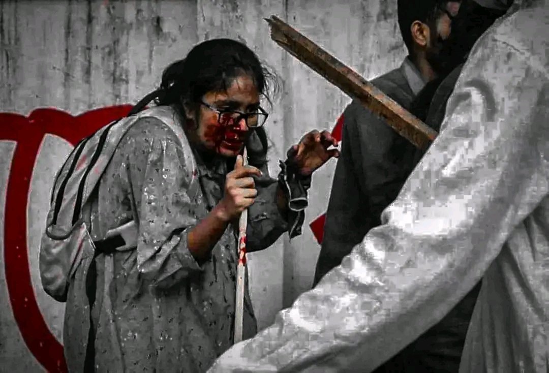 ilukmantalukder's tweet image. In the logical movement of students when the government party people torture! Today Bangladesh 🇧🇩

#Bangladesh #Dhaka #DhakaUniversityUnderAttack #DhakaUniversity #SheikhHasina #Chatraleague #Aljazeera #CNN #FoxNews #Bangladeshi #Bangladeshhighcourt #Awamileague