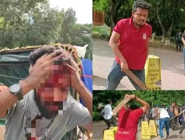 Mdjosimuddin630's tweet photo. We,the students of Bangladesh were fighting for justice against quota. Govt attacked the peaceful movement of the students. Save us #QuotaReformMovement 
#DhakaUniversityIsUnderAttack
#ALjazerra
#Bbcnews #CNN #TheWashington
#TheNewYorkTimes 
#BBC #CNBC #ProjectNightfall https://t.co/BBd1bpEsu8
