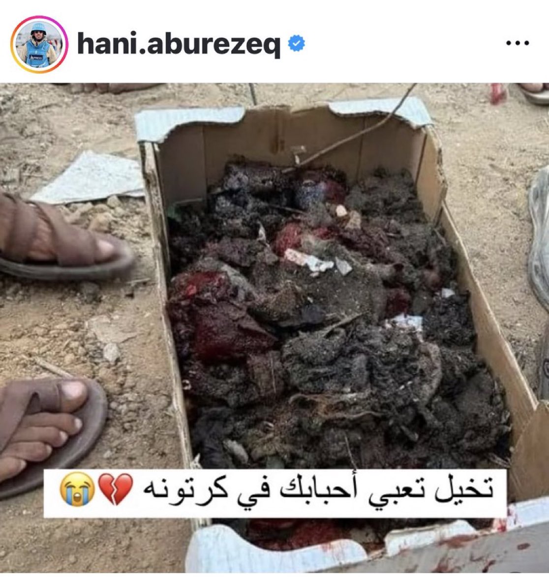 " تخيل تعبي أحبابك في كرتونة "
 
هذه بقايا أطفال غزة  في مجزرة النصيرات اليوم
