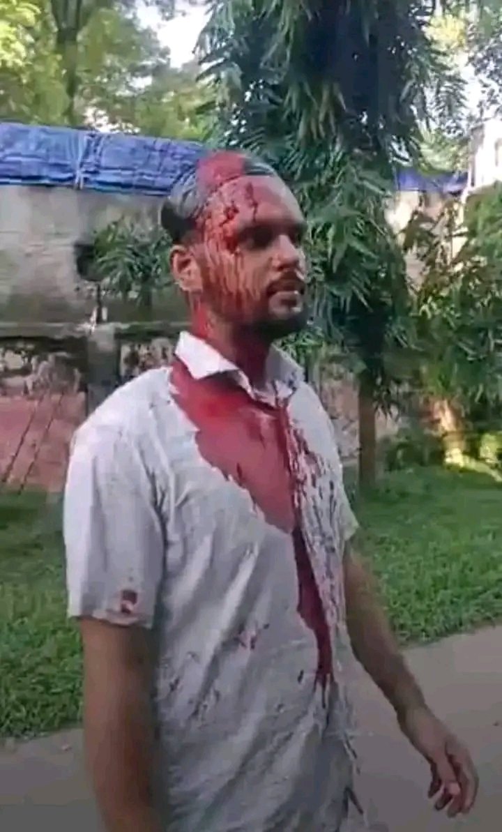 haquemi_'s tweet photo. Students here in Bangladesh are being attacked for protesting against discrimination, hundreds are already severely injured

#StudentsUnderAttack
#DhakaUniversityUnderAttack
#DuUnderAttack
#BslTerrorism
#QuotaReformMovement 
#ReformQuota
#QuotaNotComeback

#AllEyesOnBangladesh https://t.co/u8zfEQqq6o