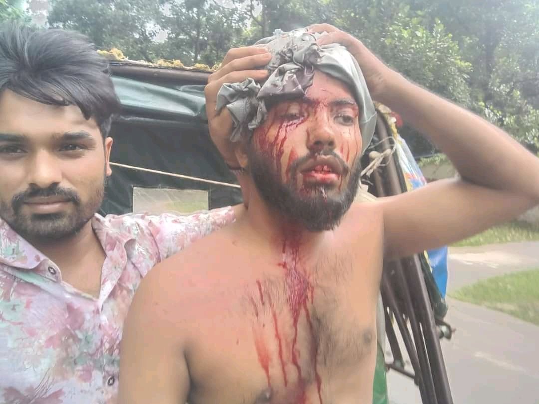 haquemi_'s tweet photo. Students here in Bangladesh are being attacked for protesting against discrimination, hundreds are already severely injured

#StudentsUnderAttack
#DhakaUniversityUnderAttack
#DuUnderAttack
#BslTerrorism
#QuotaReformMovement 
#ReformQuota
#QuotaNotComeback

#AllEyesOnBangladesh https://t.co/u8zfEQqq6o