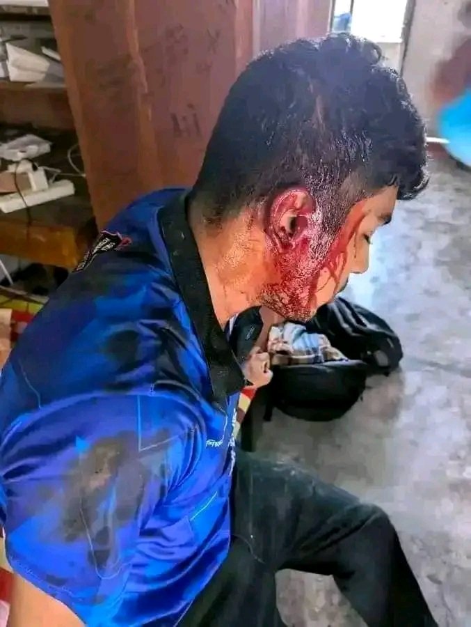 haquemi_'s tweet photo. Students here in Bangladesh are being attacked for protesting against discrimination, hundreds are already severely injured

#StudentsUnderAttack
#DhakaUniversityUnderAttack
#DuUnderAttack
#BslTerrorism
#QuotaReformMovement 
#ReformQuota
#QuotaNotComeback

#AllEyesOnBangladesh https://t.co/u8zfEQqq6o