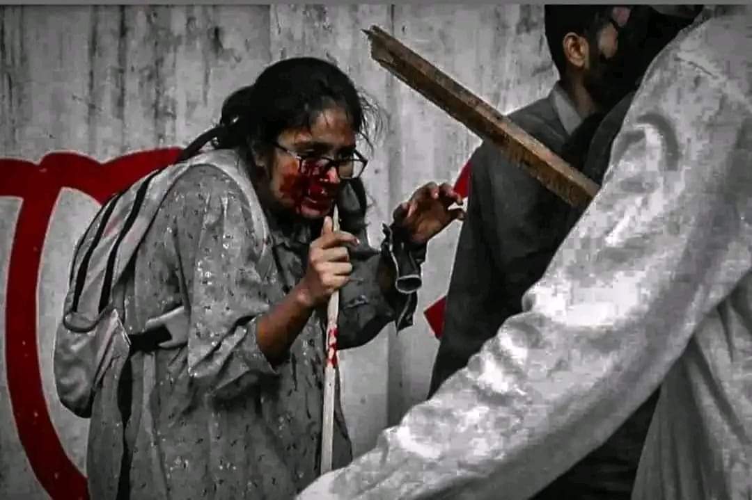 israkrabin's tweet photo. Save Bangladesh student 😭🇧🇩
My brother, sister dying.
#Bangladesh #AlJazeera #CNN #shame https://t.co/gjwHQcWEow