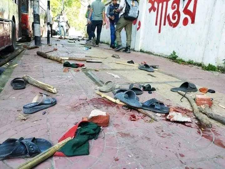 israkrabin's tweet photo. Save Bangladesh student 😭🇧🇩
My brother, sister dying.
#Bangladesh #AlJazeera #CNN #shame https://t.co/gjwHQcWEow