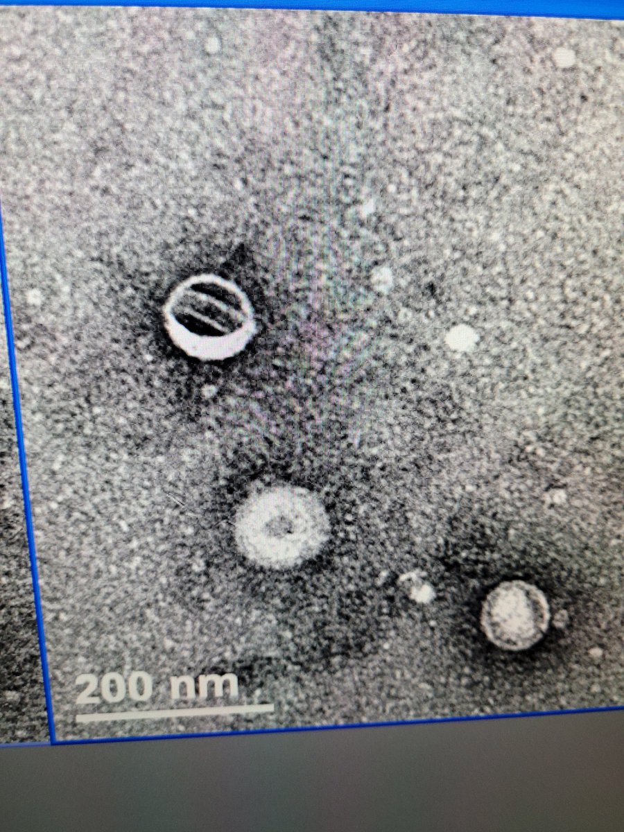 This looks like a cricket ball..
<a href="/imaging/">Masters of Imaging</a>
<a href="/tem/">Terry Muskoff</a>