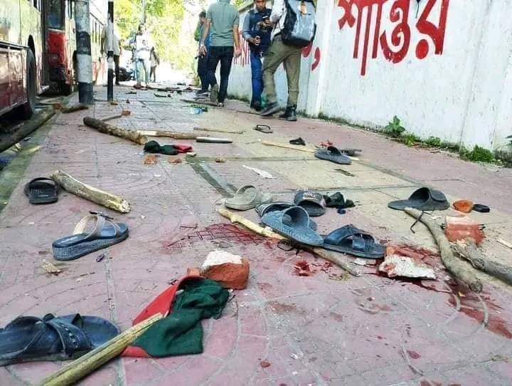 nabila2236's tweet photo. 🔴 Tragic news from #Dhaka University:
Over 100 students were injured in a brutal attack by Chhatra League members in front of the VC's building. Reports indicate several female students were also harassed by ruling @albd1971's student wings.
#QuotaMovement #PrayForStudents https://t.co/oXvyLoMvWg