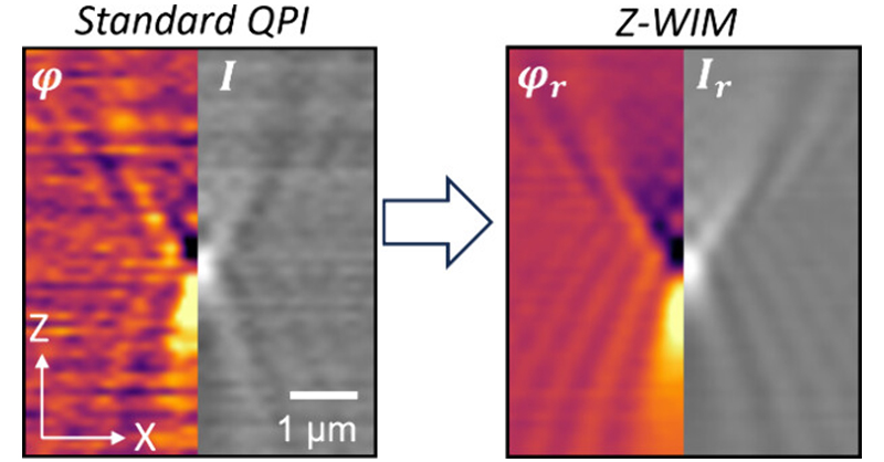acsnano's tweet image. Scientists at @Sorbonne_Univ_ and @InstVisionParis propose Zernike wavefront imaging microscopy as a simple and robust way to enhance the #QuantitativePhaseImaging of #nanoparticles for their characterization. 

Read this #OpenAccess article: go.acs.org/aa6