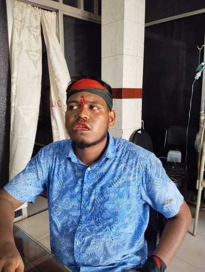 VotingStre19718's tweet photo. ‼️Plz Read‼️
Students in Bangladesh have been protesting against the quota system. However, today about 100 students of Dhaka University were attacked. International moots, please help us trend.
#StudentsUnderAttack
#UniversitiesUnderAttack
#BslTerrorism
#QuotaReformMovement https://t.co/CDNX86LDaE