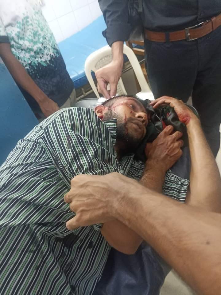 VotingStre19718's tweet photo. ‼️Plz Read‼️
Students in Bangladesh have been protesting against the quota system. However, today about 100 students of Dhaka University were attacked. International moots, please help us trend.
#StudentsUnderAttack
#UniversitiesUnderAttack
#BslTerrorism
#QuotaReformMovement https://t.co/CDNX86LDaE