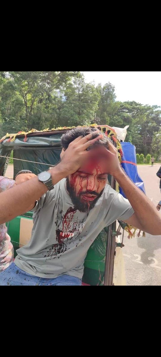 __byeeeee___'s tweet photo. Hello world
Your brothers and sisters are in danger. We need your help🙏
Pls spread this share this
#bangladesh_quota_movement 
#SaveBangladeshiStudents https://t.co/hSYiilhojR