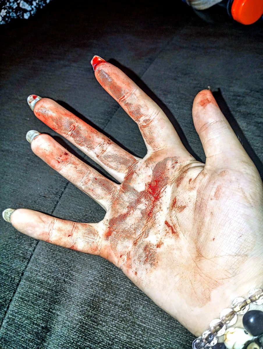 lus_corpse's tweet photo. Arm cuts :> #sh #selfharm #shtwt #cuts #armcuts #blood #bloody #bloodkink #bloodyarm #bloodyhand #bloodythigh #tattoo #stickandpoke #styro #hitthestyro https://t.co/zRXeZSbNLm