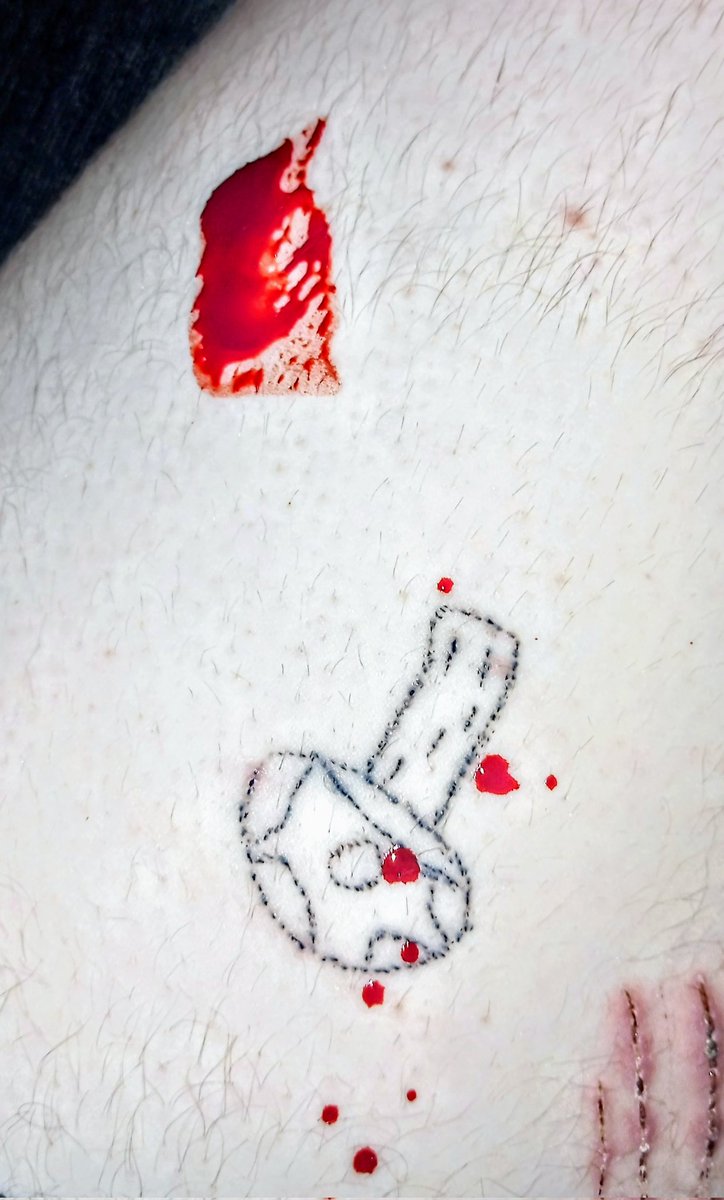 lus_corpse's tweet photo. Arm cuts :> #sh #selfharm #shtwt #cuts #armcuts #blood #bloody #bloodkink #bloodyarm #bloodyhand #bloodythigh #tattoo #stickandpoke #styro #hitthestyro https://t.co/zRXeZSbNLm
