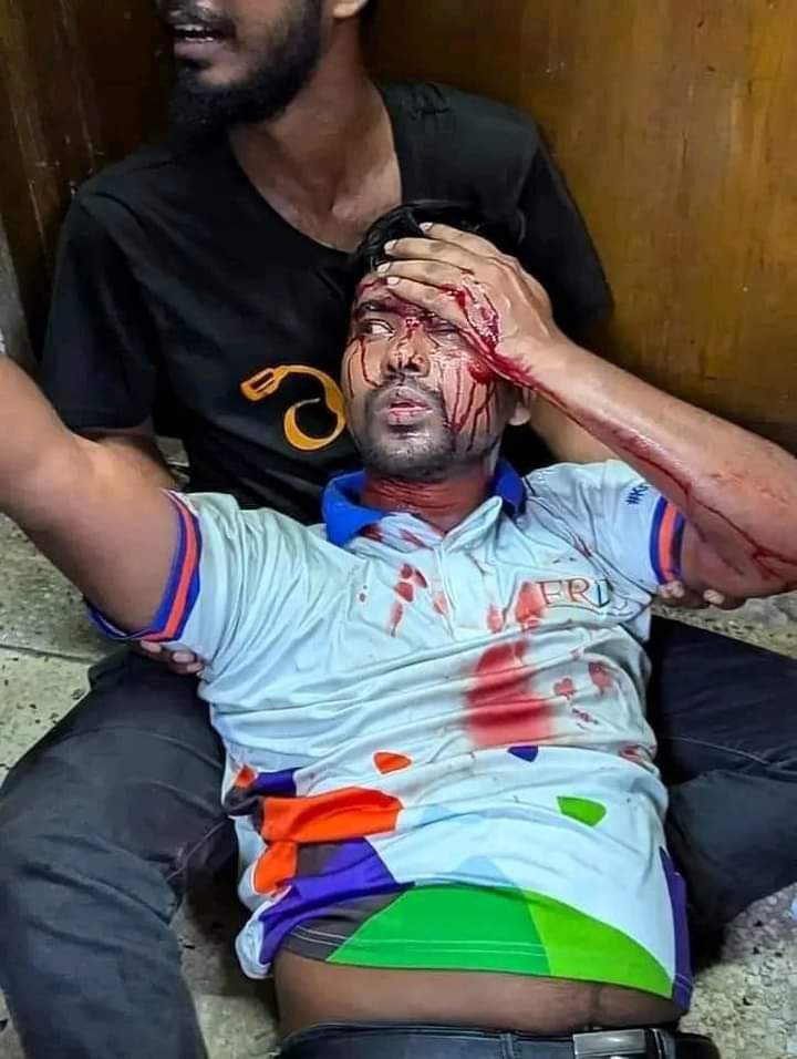 mahfooz750's tweet photo. These pictures are from Bangladesh, where students are protesting against job quotas. Students asked for justice for all talented students, and this was their reward 💔

#Bangladesh
#Save_Bangladeshi_students
#DhakaUniversityUnderAttack
 #QuotaReformMovement 
#Qouta_Reform https://t.co/MLzH7UssfQ