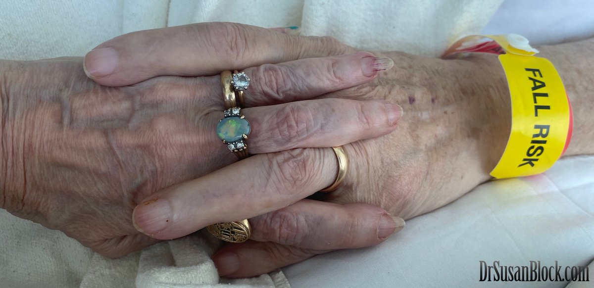 drsuzy's tweet photo. Thank you for the beautiful messages of support for Capt'n Max since his recent stroke🧠 These pics are from the hospital, rehab & "Birthday Healing"👀 Best #Stroke Medicine is #Stroking😘 & Holding Hands🫱🏽‍🫲🏼 Read My Journal & Watch the Show: https://t.co/hdhdVS6IkY 👈🏼
#Hands #HoldingHands #Healing #HealingTouch 🫶🏼  #FallRisk #Mask #MedicalFetish⚕️ #InSicknessandInHealth💒
#TheGoalistheJourney🛤️
#LoveWillFindaWay💖