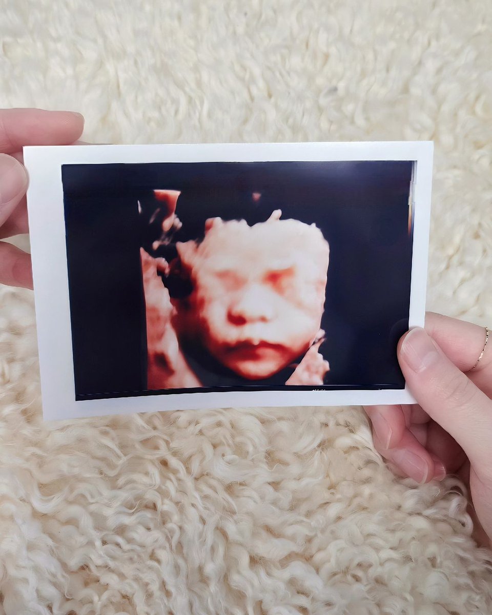 tomozuki1's tweet image. [แปล] 2024.07.16
#Sungmin #성민 IG:

สวัสดีครับ ซองมินครับ.

ผมเขียนข้อความอย่างระมัดระวังเพื่อแจ้งข่าวกับแฟนๆทุกคนก่อนครับ.

เด็กน้อยที่แสนล้ำค่ามาหาผมแล้วครับ. หลังจากแต่งงานได้10ปี ผมกลายเป็นพ่อคนแล้วนะครับ.

ผมจะรับผิดชอบ…