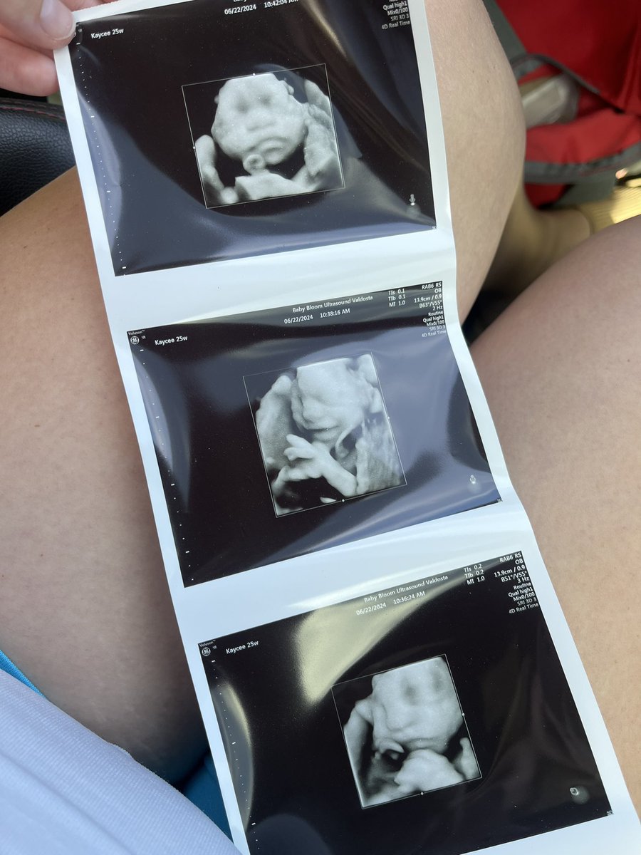 kaycee_breann's tweet photo. MINE🥹🥹🥹💙 #babyboy #cominginoctober https://t.co/b4KnfaheHN