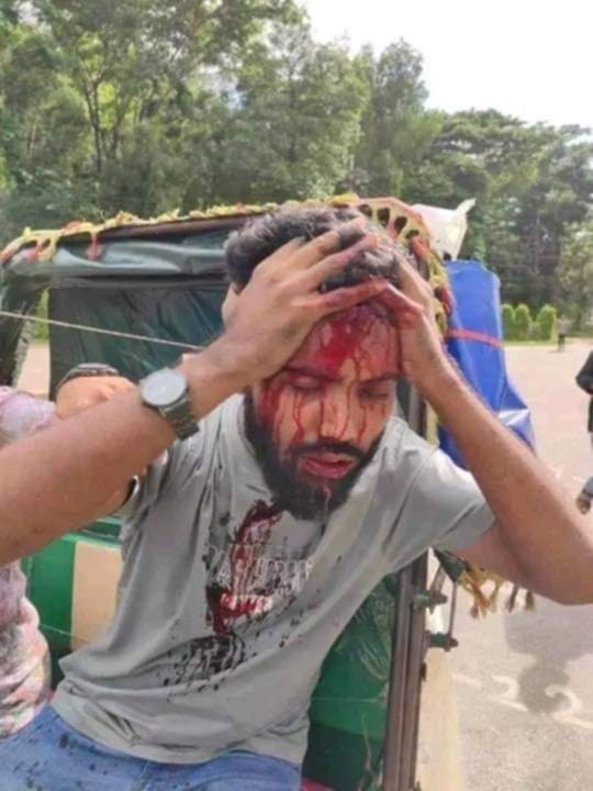 salmavklbd's tweet photo. #Save_Bangladeshi_students #ALjazerra #Bbcnews #CNN #TheWashingtonPost #TheNewYorkTimes #TheGuardian #BBC #AlJazeeraEnglish #TheWallStreetJournal #CNBC #DhruvRathee #UnitedNations #NewYorkTimesOpinion #ABCNews #NewYorkPost #ProjectNightfall #AbhiandNiyu #QuotaReformProtest https://t.co/N7l2ga7pL4