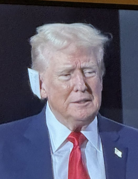 FreeIsMe3's tweet photo. EAR.... TV #TamponDon 

same day...what a con

#RNC #RNC24 #gop #Republican #RepublicanNationalistConvention 
#manbc #cnn #Foxnews #ear #AssassinationAttempt #VoteTeamJoe2024 https://t.co/d0VENYq1yk