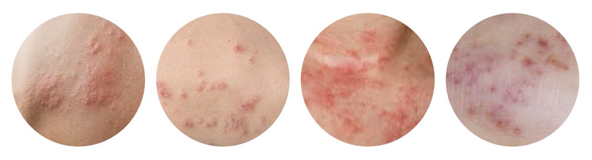 Louise stone tweet media