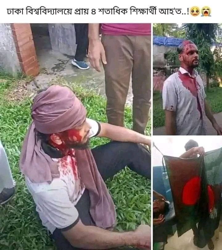 NFTGallery01's tweet photo. This is the Bangladesh we wanted? 

Bangladesh Chatro League gangsters are beating innocent girls in the quota reform protest. 
This is not independency. This is not democracy. 

Shame on the system. 

#QuotaMovement #Bangladesh #AlJazeeraEnglish @AlJazeeraWorld 
#StudentProtest https://t.co/MD9hsRrmz2