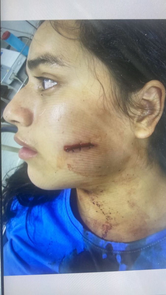 guamoargelia's tweet photo. Líderes sociales #Solicitan @petrogustavo @FranciaMarquezM  extracción segura después de las amenazas y 18 líderes asesinados Los van a matar El Cañón del Micay siguen en manos de los terroristas todo pasa bajo la mirada permisiva de ls FFMM https://t.co/bg9q4nnjTr