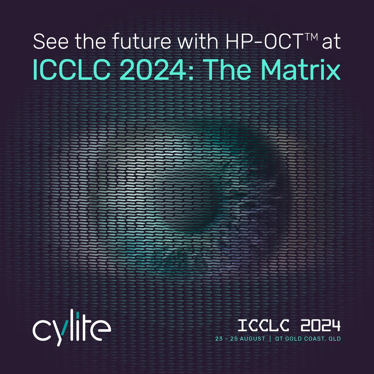 CyliteOptics's tweet photo. If you’re attending, book your HP-OCT demo now to see the future of whole-eye imaging and management!
#ICCLC #ICCLC2024 #Optometry #Cylite #HPOCT #Ophthalmology #EyeHealth #Cornea #Myopia #OrthoK #Keratoconus #ScleralLens https://t.co/e9Ukduz5kV