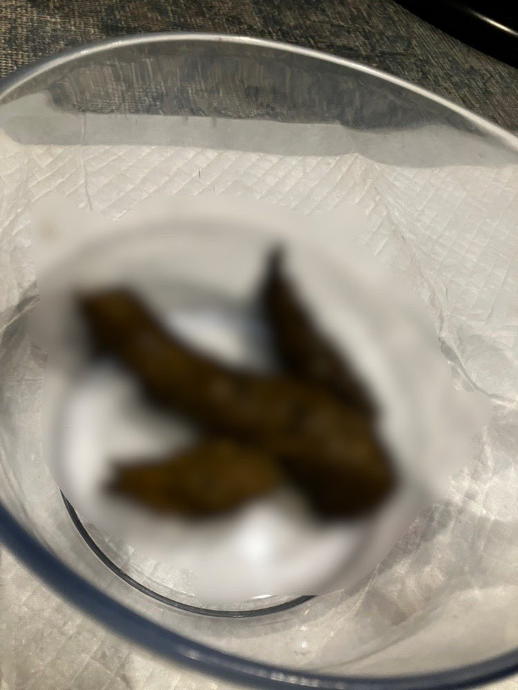 Sayuri___u's tweet photo. シンプルなうんち💩

先日はシンプルに透明な手桶にうんちするところを観察してもらいました！！

買ってきていただいたスイーツを食べながらいろんなお話をじっくり楽しむ"普通"の時間を過ごし…

そこからの��んち観察はギャップが大きくてドキドキしました💓

Nさん、ありがとうございました🫶🏻 https://t.co/PqfIIyOJOU