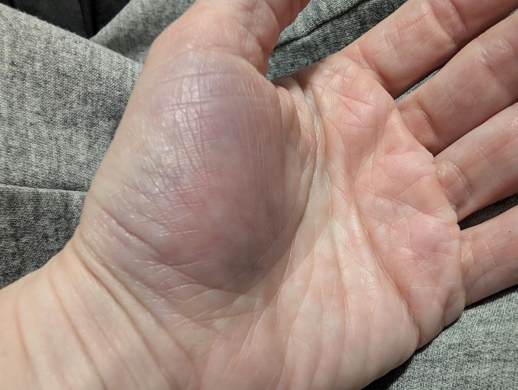 JayAg12's tweet photo. Well... Today didn't go as planned.. fml.. stay tuned to find out if I broke my fkn hand or not 😩🤮🤬 https://t.co/Y9ZGDDjuiN