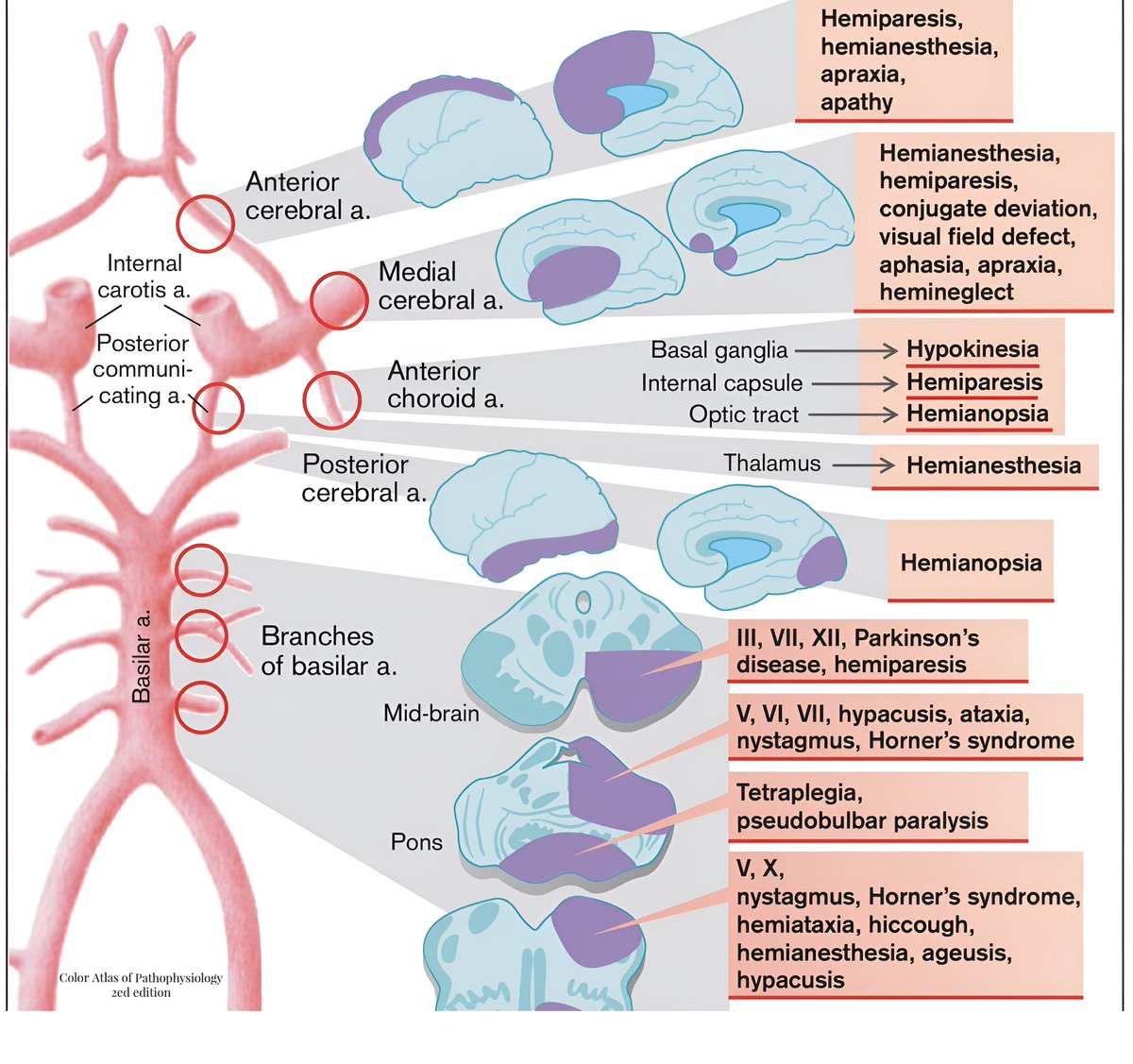 Vascular Occlusion as Cause of Ischemia