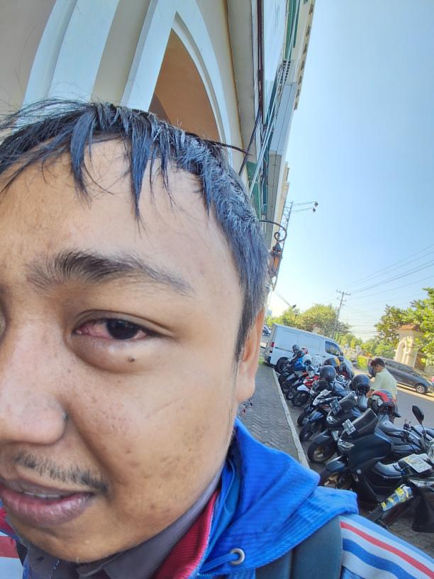merapi_uncover's tweet photo. Mohon maaf. Untuk para pengendara motor,tolong sekali agar tidak meroko sambil berkendara. 
Barusan kejadian sama saya min, Abu rokok masuk mata. Tolong utk sedulur2 semua merokok itu enak sambil ngopi,kalo merokok di jalan kasihan pengendara lain,apalagi abu rokok sampe masuk mata. Perihh gessss...

(Michaeljhon.p)