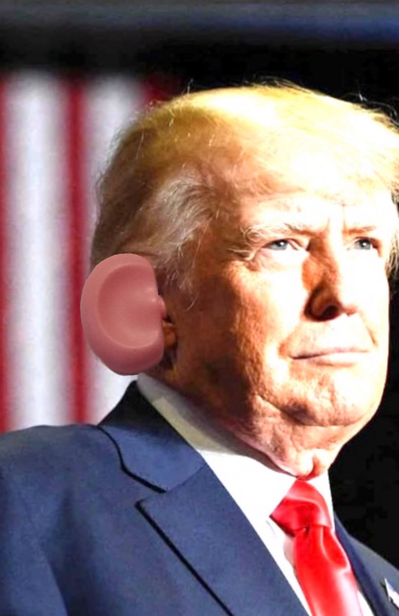 MeachamDr's tweet photo. While the ear tissue heals, they’ve decided to use a Mr Potato Head ear as a temporary. https://t.co/C7NP3XuA1u