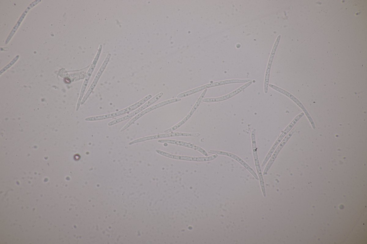 RPilze's tweet photo. Septoria apiicola ex Apium graveolens
#Apiumgraveolens #Apium #Sellerie #celery #Céleri #sedano #apio #Septoriaapiicola #Septoria #Mushroom #fungus #Pilz #Phytopathology #Nature #FungiFriends https://t.co/q8sElZSDXu