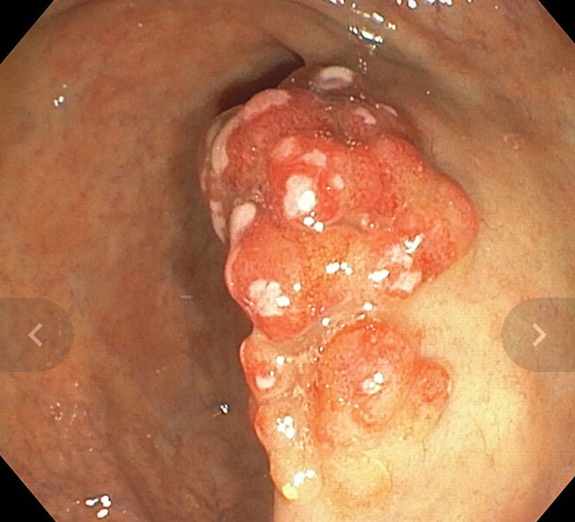 S.Enf.Infecciosas HRUM tweet media