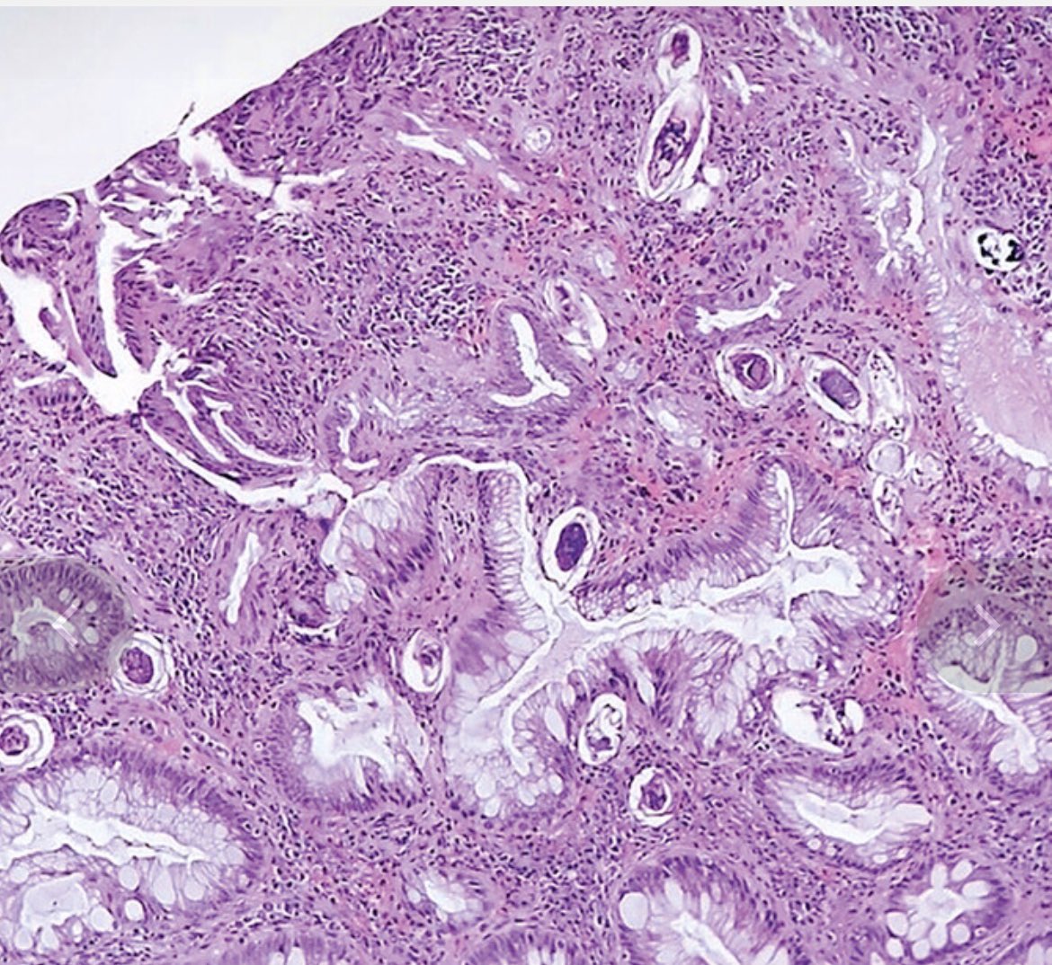S.Enf.Infecciosas HRUM tweet media
