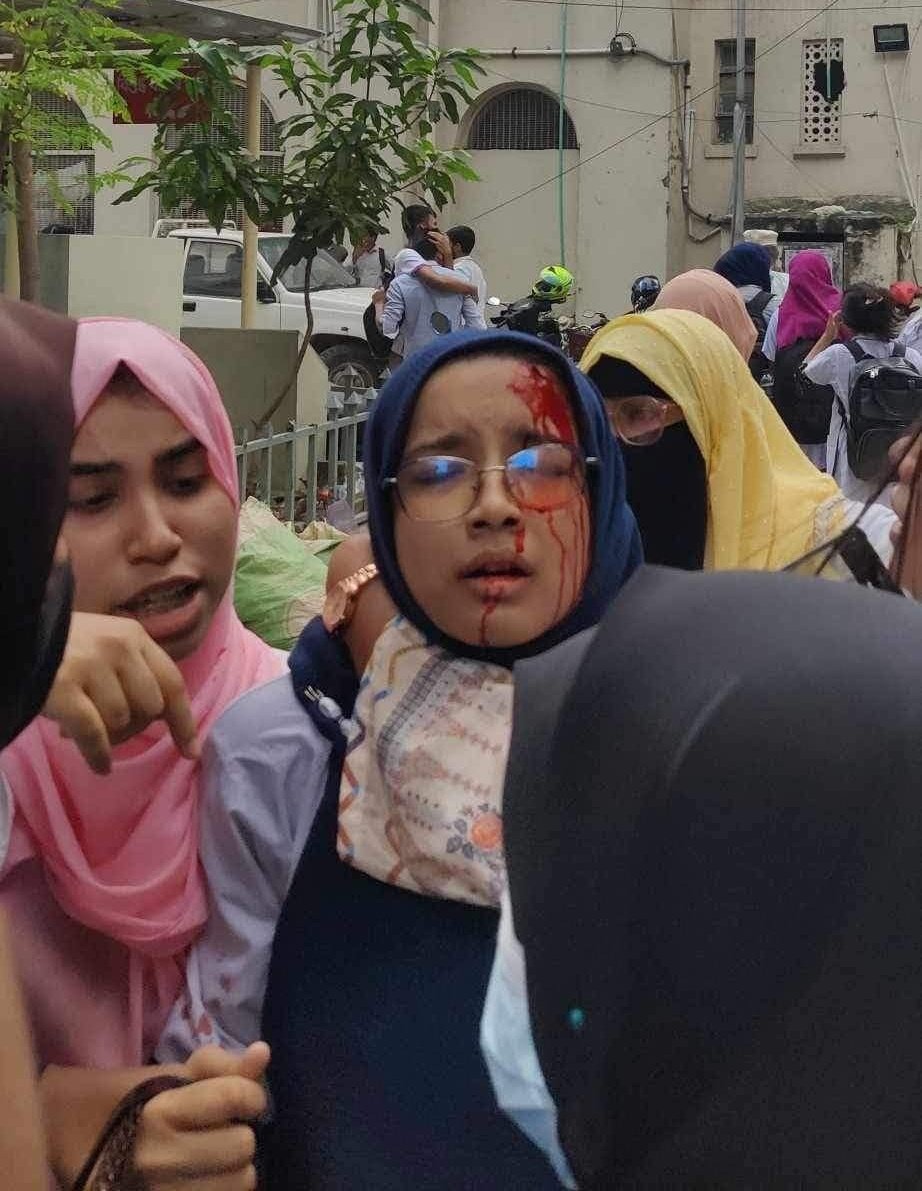 raiisdeadd's tweet photo. 📍Sir Salimullah Medical College, Dhaka.
She is an unarmed medical student!!!!! 
#Save_Bangladeshi_students 
#QuotaReformProtest 
#SaveBangladeshiStudent https://t.co/lJSv7JgWl6