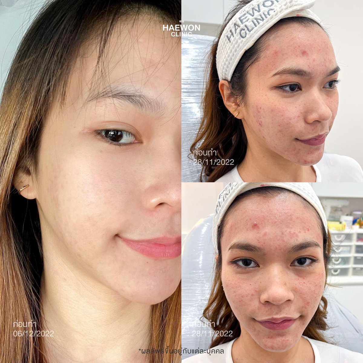 Review_Haewonclinic tweet media