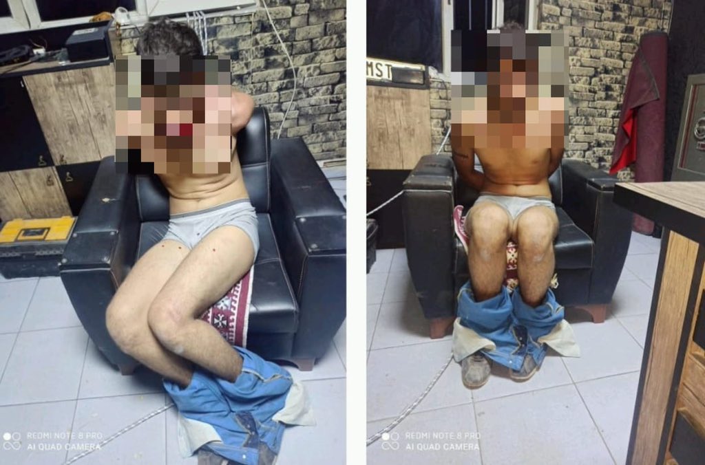 ajans_muhbir's tweet photo. ⚠️ Antalya’da korkunç olay… Ellerini kollarını sallayarak rahat rahat geziyorlar…

4 yıl önce Antepli Ahmet Usta diye bir oto bakım atölyesinde işe başlayan 22 yaşındaki Vedat Kurt, son aylarda verilmeyen maaşlarını işverenden istedi. 

4 patron tarafından önce 3 gün boyunca aç susuz bir şekilde elektrik verilerek sopayla işkenceye maruz bırakılan, böcek yedirilen, dişleri kerpetenle çekilen Kurt, daha sonra 3 ay boyunca bir odada alıkoyuldu. Yaraları iyileştikten sonra kaçmayı başaran işçi karakola giderek şikayetçi oldu.

İşkence görüntülerine 4 kişinin HTS telefon kayıtlarından ve Antalya Cumhuriyet Başsavcılığı Bilirkişi raporundan ulaşan Kurt, tüm delillere rağmen işkenceci patronların dışarıda ellerini kollarını sallayarak gezmeye devam ettiklerini, herhangi bir işlem yapılmadığını söyledi.

Kurt, 2 ay sonra tekrar bir duruşma gerçekleşeceğini aktararak Adalet Bakanlığı'na seslendi:

"Benim gibi gariban bir vatandaşın hakkını kim savunacak? Ben Adalete nasıl güveneceğim?"

(Mehmet Yetim)