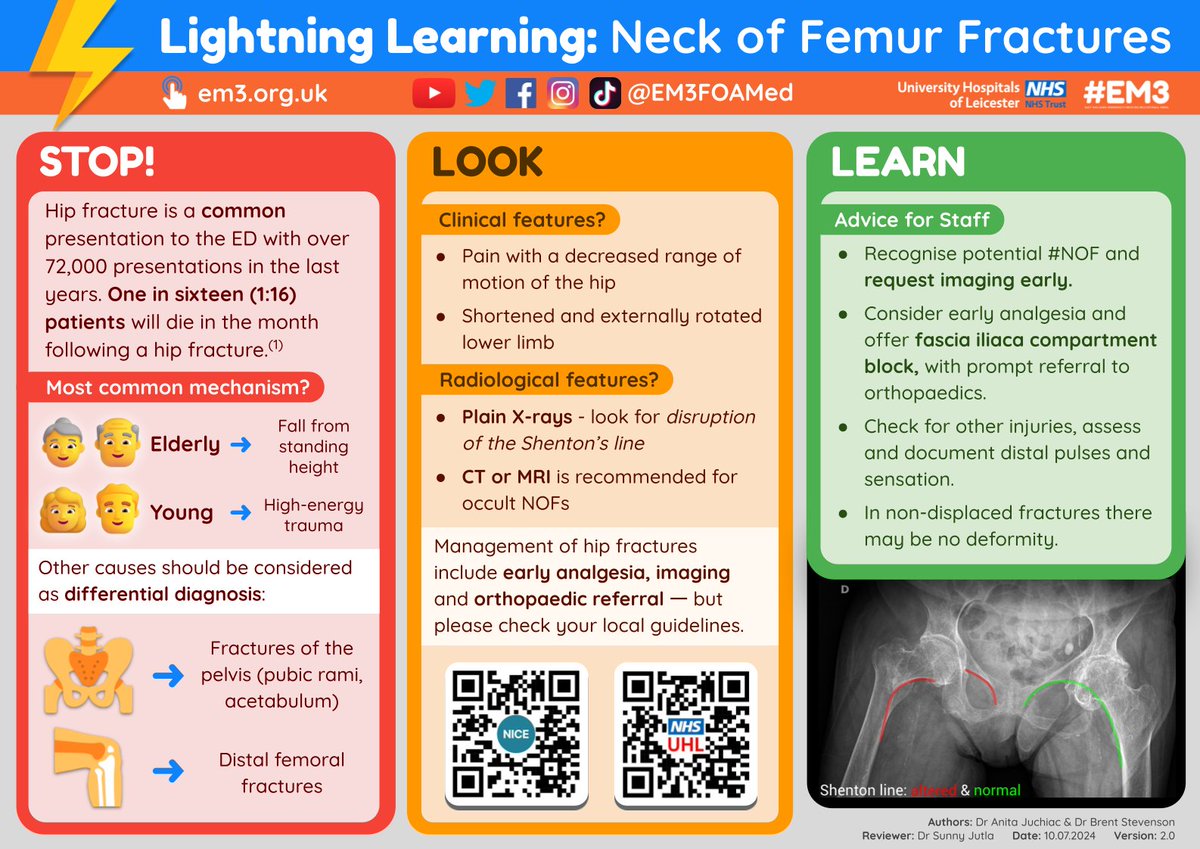 EM3FOAMed (@em3foamed) on Twitter photo Check out our updated #LightningLearning on Neck of Femur Fractures for 2024 in lead-up to a new quality improvement project <a href="/Leic_hospital/">Leicester's Hospitals</a> from ED doctors Anita Juchiac & <a href="/Brent_Stevenson/">Brent Stevenson</a> ๐
#QIP Check out our updated #LightningLearning on Neck of Femur Fractures for 2024 in lead-up to a new quality improvement project <a href="/Leic_hospital/">Leicester's Hospitals</a> from ED doctors Anita Juchiac & <a href="/Brent_Stevenson/">Brent Stevenson</a> ๐
#QIP