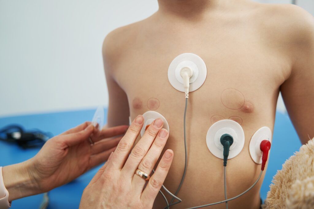 PJOnline_News's tweet photo. This month's CPD article outlines the main types of paediatric arrhythmias, diagnosis and pharmaceutical treatment options #cpdarticle #pharmacycpd #paediatricarrhythmias https://t.co/fm0xkOS45N https://t.co/WDl9pMcmxA