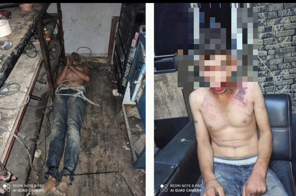 darkwebhaber's tweet photo. (HASSAS) Antalya'da 4 yıl önce bir oto bakım atölyesinde işe başlayan 22 yaşındaki Vedat Kurt, son aylarda verilmeyen maaşlarını işverenden istedi.

4 patron tarafından önce 3 gün boyunca aç susuz bir şekilde elektrik verilerek sopayla işkenceye maruz bırakılan, böcek yedirilen, dişleri kerpetenle çekilen Kurt, daha sonra 3 ay boyunca bir odada alıkonuldu. Yaraları iyileştikten sonra kaçmayı başaran Kurt, karakola giderek şikayetçi oldu.

4 kişiyi şikâyet etmesine ve HTS kayıtlarında işkence görüntülerinin çıkmasına rağmen zanlılar hakkında cezai yaptırım uygulanmadığını belirten Kurt, adalet çağrısında bulundu. (Mehmet Yetim)