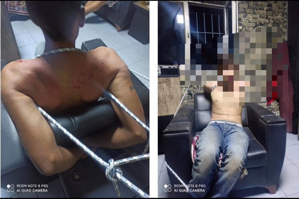 darkwebhaber's tweet photo. (HASSAS) Antalya'da 4 yıl önce bir oto bakım atölyesinde işe başlayan 22 yaşındaki Vedat Kurt, son aylarda verilmeyen maaşlarını işverenden istedi.

4 patron tarafından önce 3 gün boyunca aç susuz bir şekilde elektrik verilerek sopayla işkenceye maruz bırakılan, böcek yedirilen, dişleri kerpetenle çekilen Kurt, daha sonra 3 ay boyunca bir odada alıkonuldu. Yaraları iyileştikten sonra kaçmayı başaran Kurt, karakola giderek şikayetçi oldu.

4 kişiyi şikâyet etmesine ve HTS kayıtlarında işkence görüntülerinin çıkmasına rağmen zanlılar hakkında cezai yaptırım uygulanmadığını belirten Kurt, adalet çağrısında bulundu. (Mehmet Yetim)