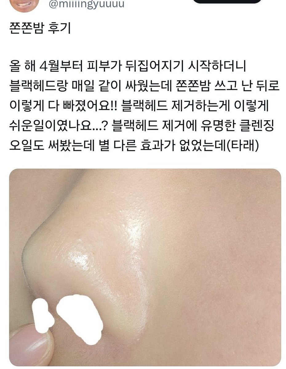 manduuiilsang's tweet photo. 내맘대로 덕자드리기 인원제한x
금액 제 마음대로입니다!!

현재 위너홀스솝은 1가지이상 구매시
속눈썹생장밤을 증정해드립니다‼️💚
여기서 3가지이상 구매시 바디워시를
추가로 증정해���릴게요 ⭕️

https://t.co/2ui2NkzVJM 

쫀쫀밤은 바르고 5분뒤 면봉으로 닦고
그위에 쫀쫀앰플 써주시면 더 좋아요!!
코가 사진처럼 깔끔해지고 블랙헤드 빠지는
그런 효과 🩵🩵🩵🩵

태양앰플은 누런기 쫙 빼주고 피부톤업‼️
효과가 상당히 좋습니다 ㅎㅎㅎㅎㅎ
감사합니다 꾸벅