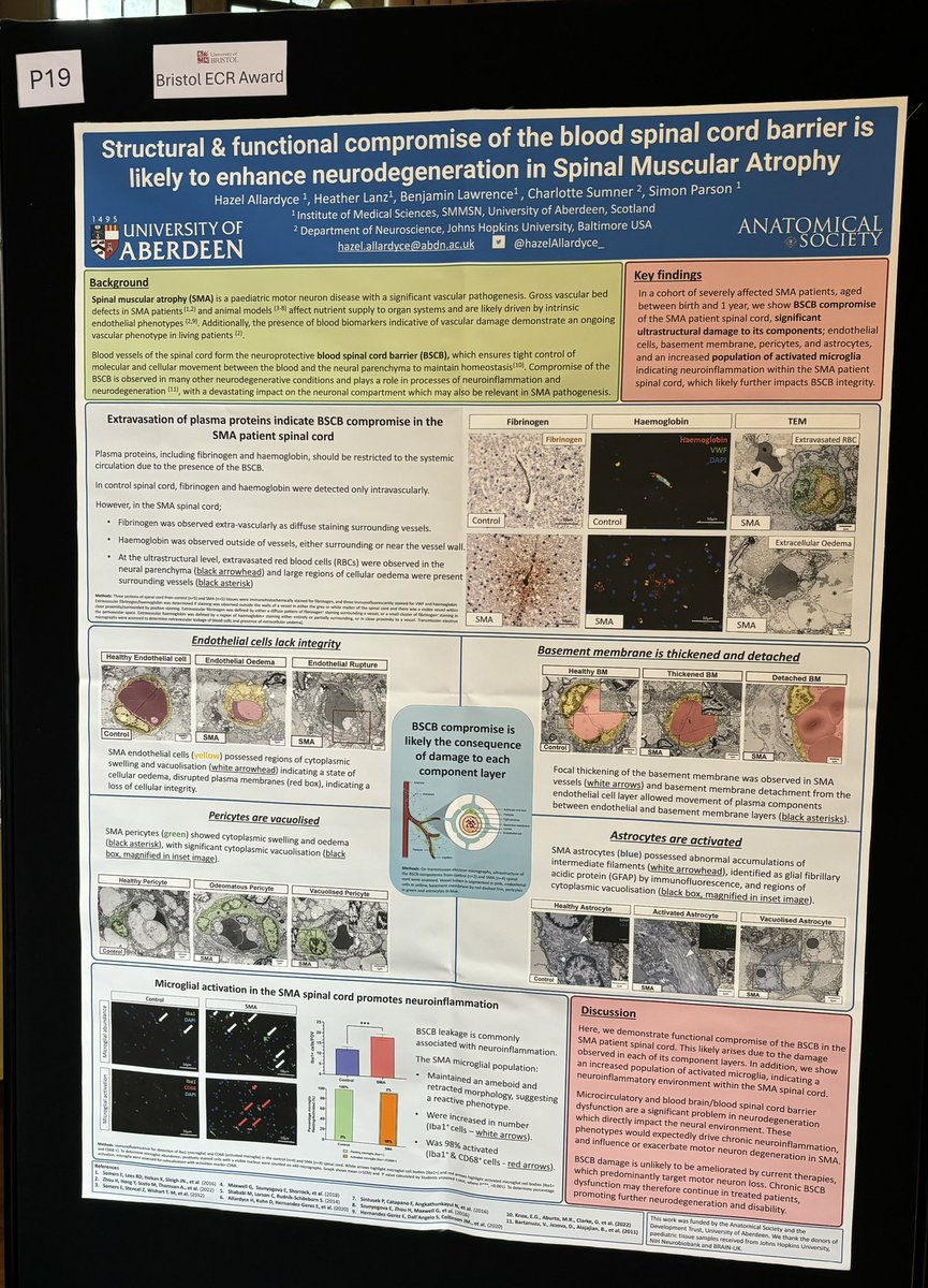 hazelAllardyce_'s tweet image. Attending @BMVBSoc in Bristol? 
Stop by to see my poster on blood spinal cord barrier compromise in spinal muscular atrophy at lunchtime today! 👩‍🔬🧠 🔬
@ParsonLab @NEAnatomist 
#SMA #vascularpathology